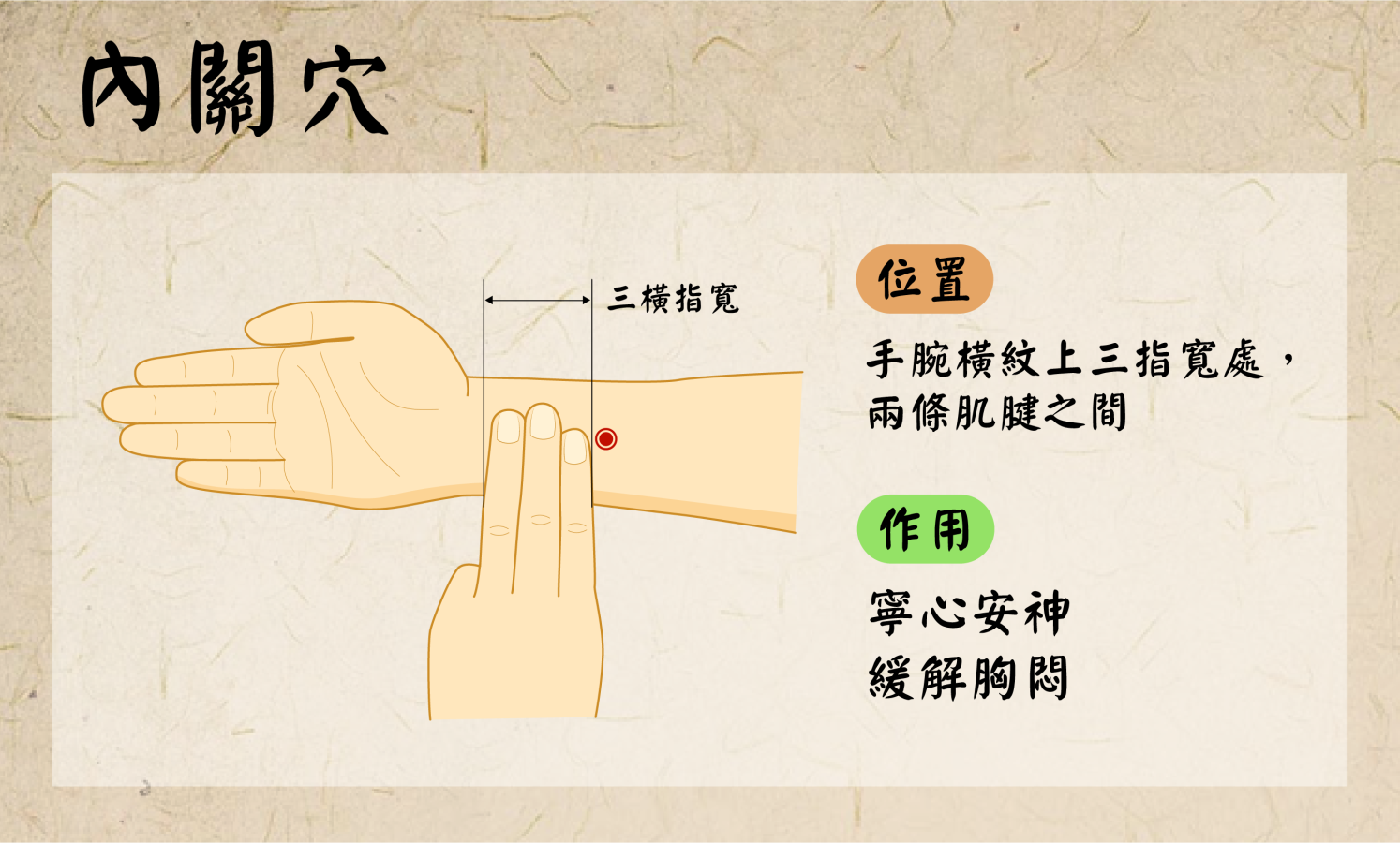 1150514-3-按摩內關穴寧心安神緩解胸悶圖片由北市聯醫繪製.png