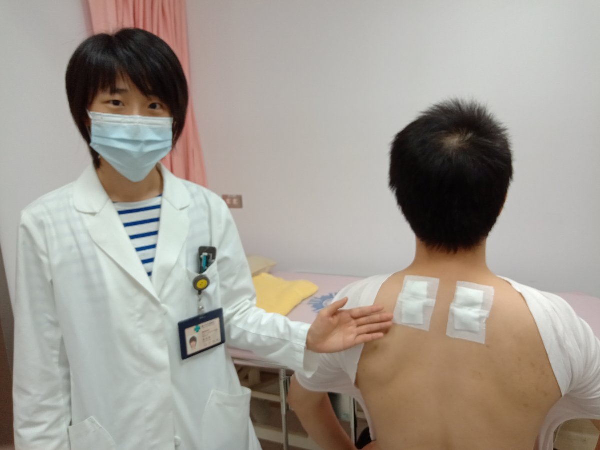 三伏貼