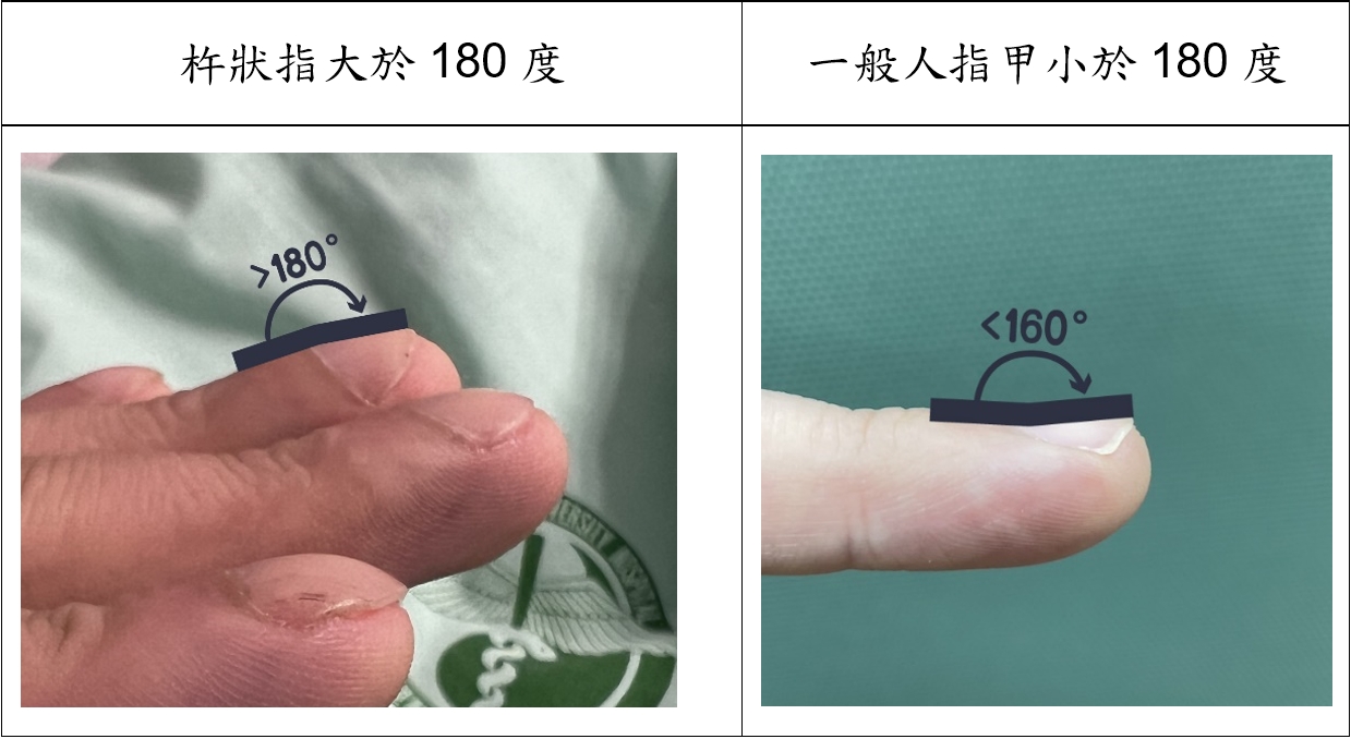 圖三