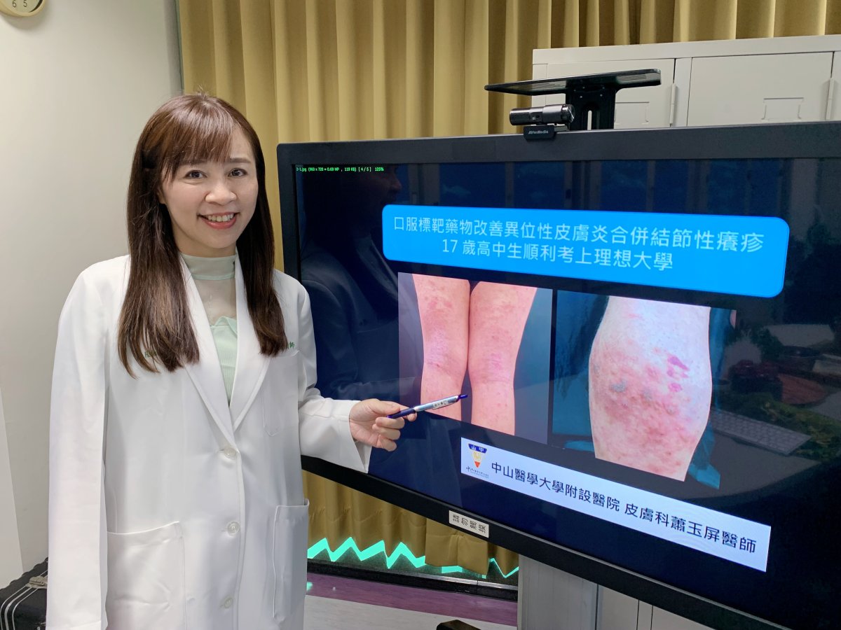 圖1 中山醫學大學附設醫院皮膚科蕭玉屏醫師