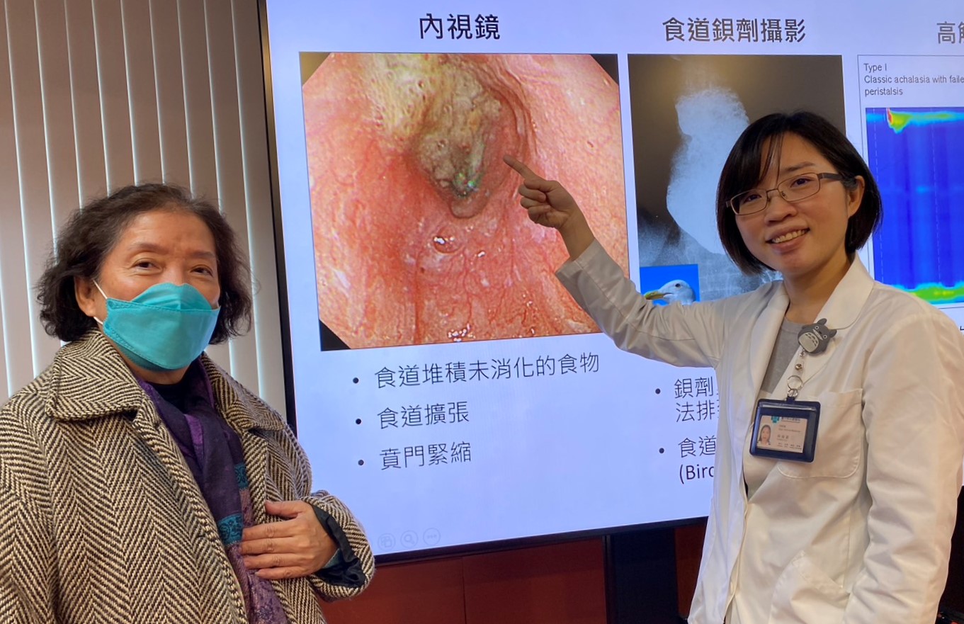 圖說臺中榮總胃腸肝膽科醫師林宛姿右透過內視鏡檢查嚴女士左食道有未消化的食物