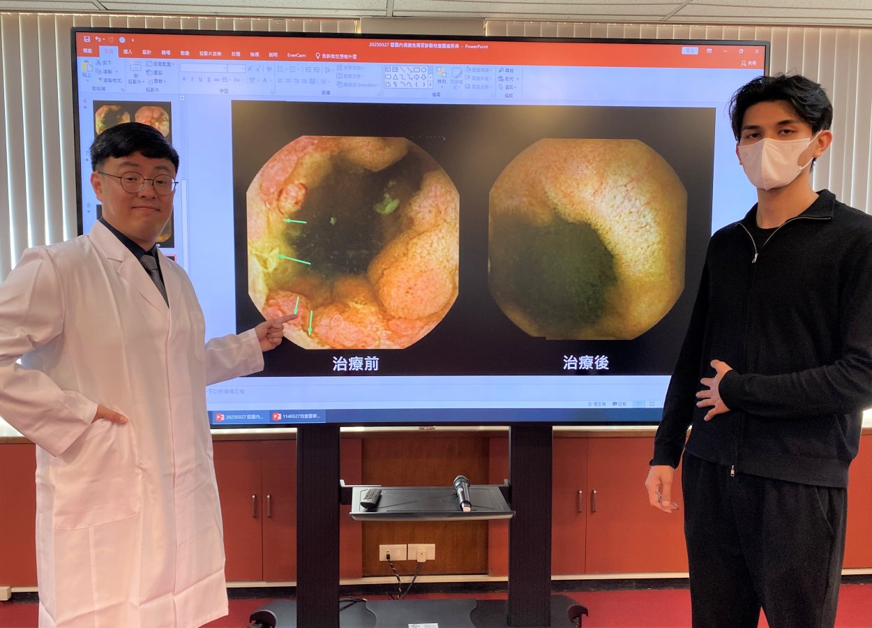圖22說臺中榮總兒童醫學中心醫師黃彥筑左運用膠囊內視鏡診斷病人耿先生右罹患克隆