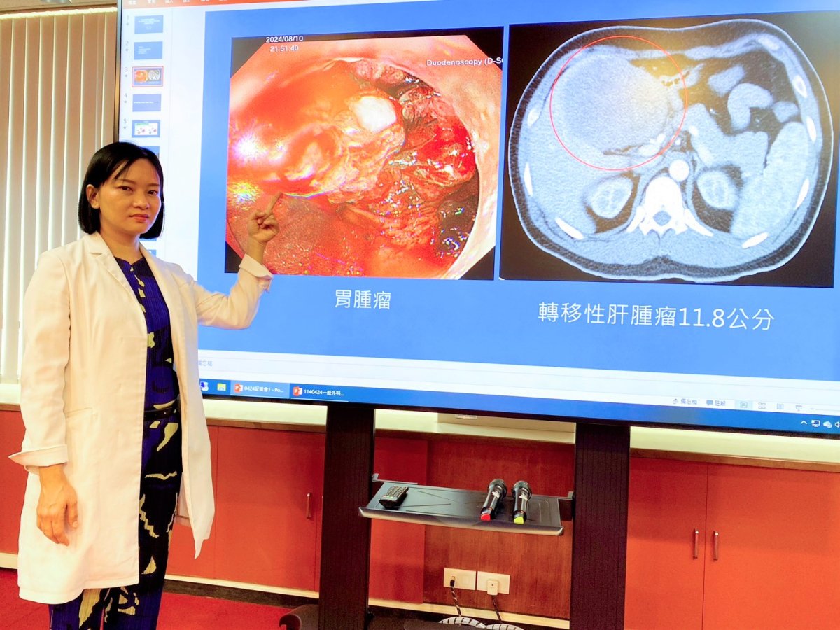 圖1說臺中榮總一般外科主任陳怡如解釋胃癌晚期病患不容易進行手術術前經跨科治