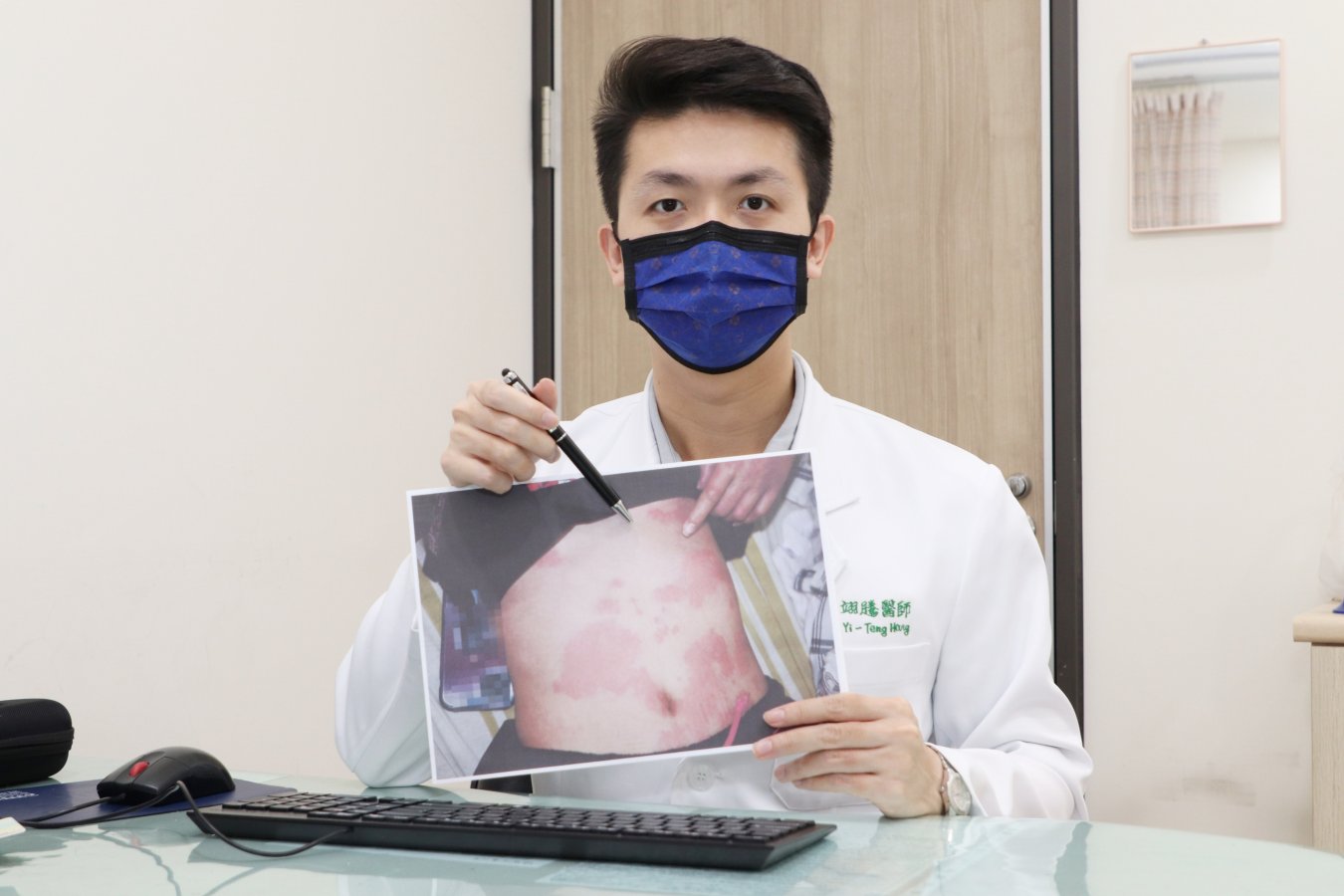 洪翊騰醫師指出蕁麻疹性血管炎因小血管發炎常造成紫斑樣變化照片IMG 9630