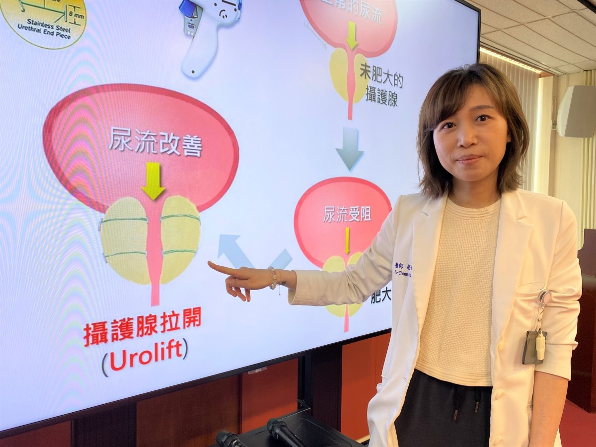 2中榮總泌尿醫學部醫師胡如娟說明攝護腺拉開術沒有破壞攝護腺組織屬物理方式治