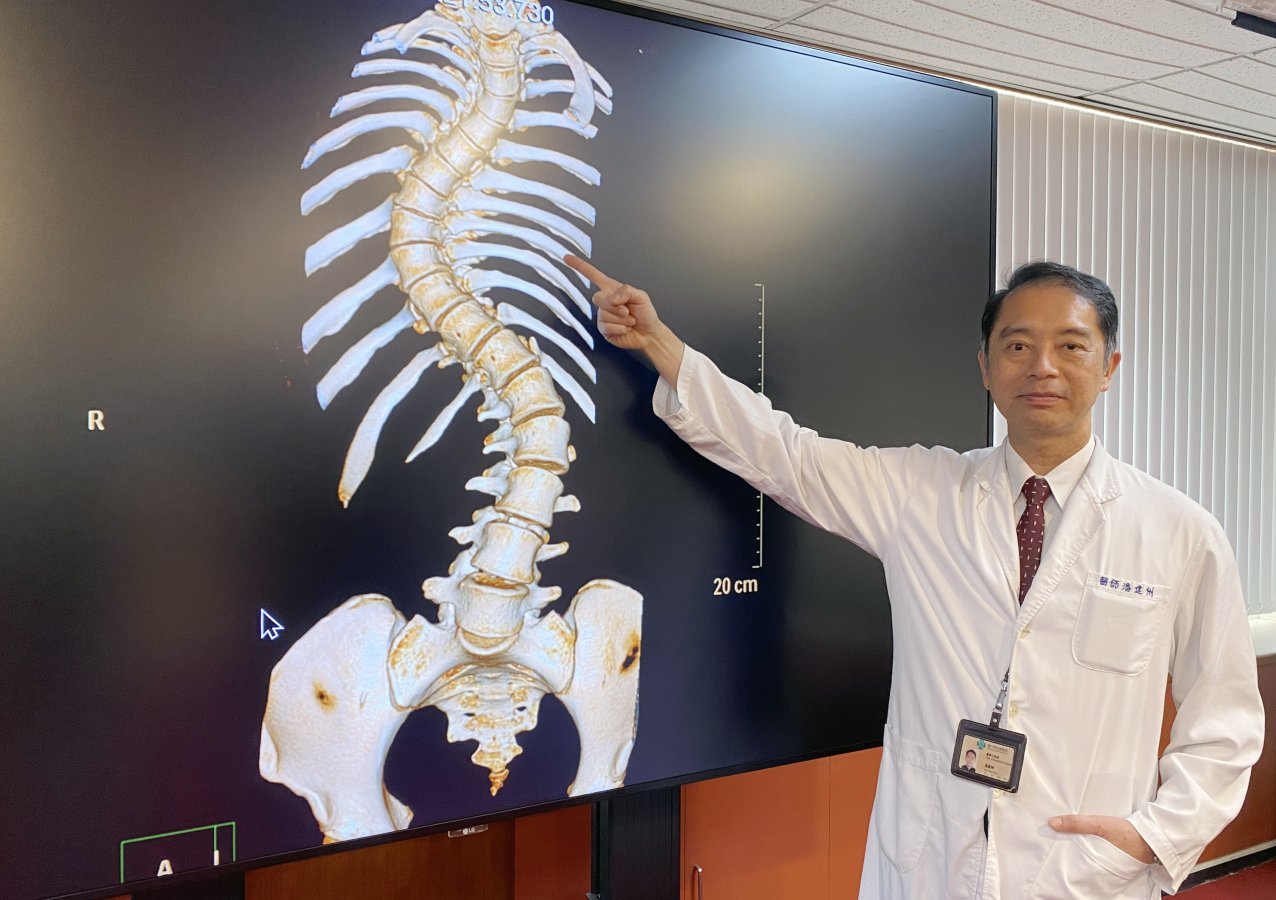 3中榮總骨科部脊椎外科主任潘建州指出黃同學術前電腦斷層可清晰看到其脊椎嚴重側