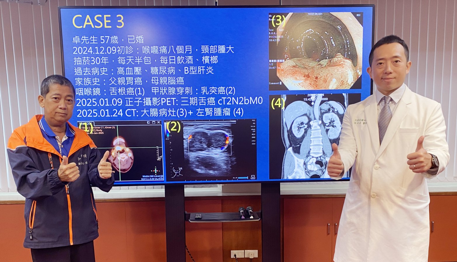 愛運動的卓先生左因反覆喉嚨痛就醫發現全身有4處原發性癌症其中大腸癌及左腎 copy