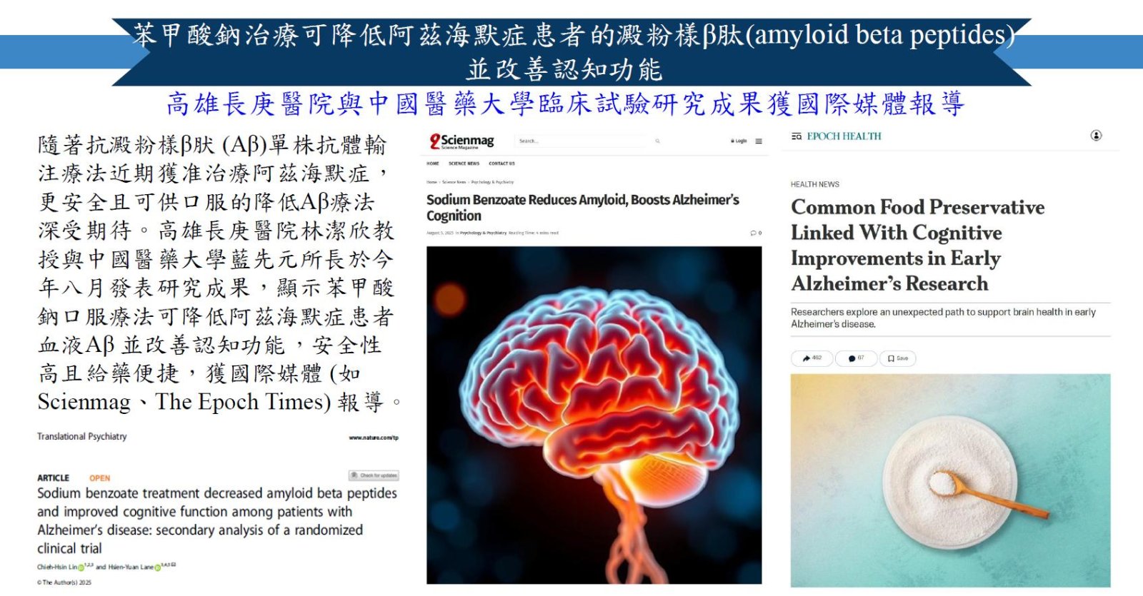 苯甲酸鈉治療可降低阿茲海默症患者的澱粉樣β肽並改善認知功能臨床研究成果1
