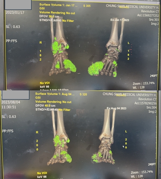 2995